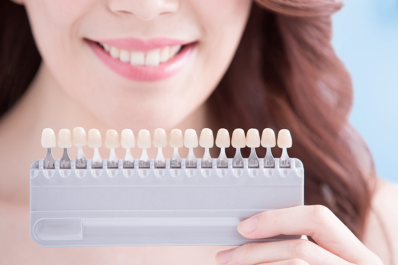 The Science Behind Teeth Whitening
