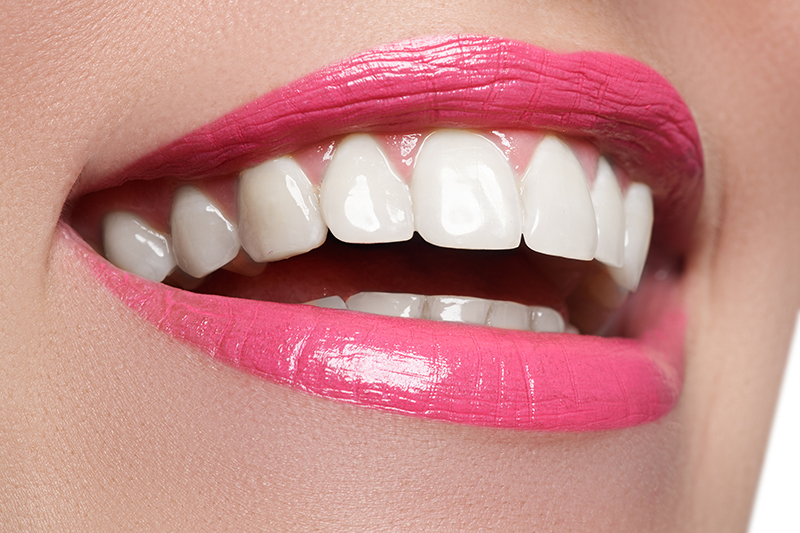 Porcelain Veneers Can Give You a Hollywood Smile